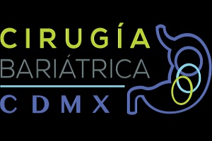 Cirugía Báriatrica CDMX
