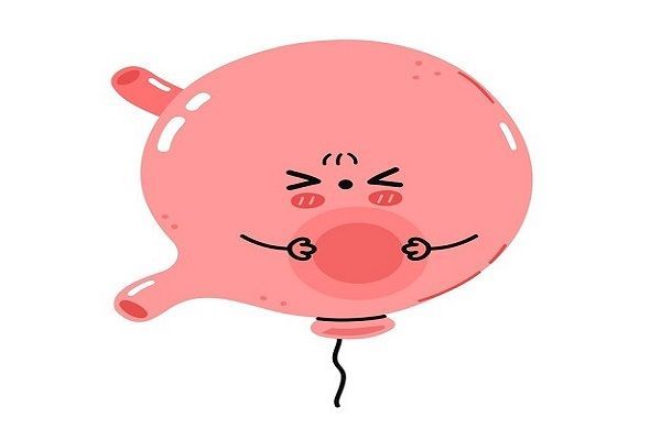 Gastric Balloon