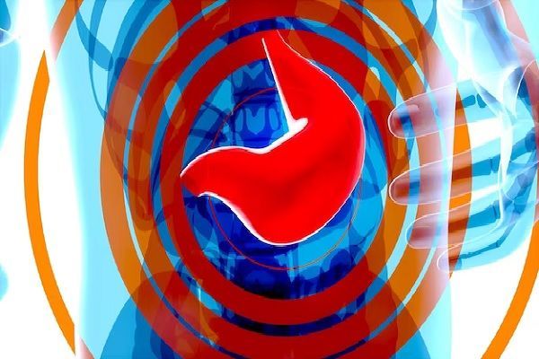 Gastric Balloon