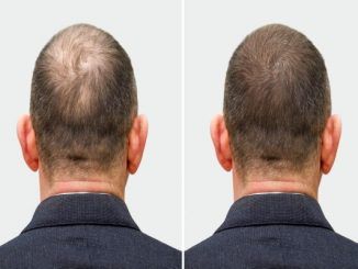 Hair transplant clinic
