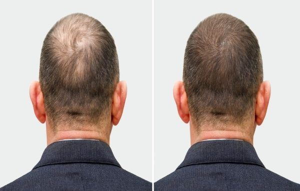 Hair transplant clinic