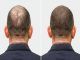 Hair transplant clinic