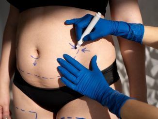 abdominoplasty clinics in Mexico City