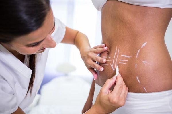liposuction clinics