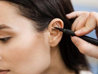 Surgeon draw marking on ear before otoplasty cosmetic surgery