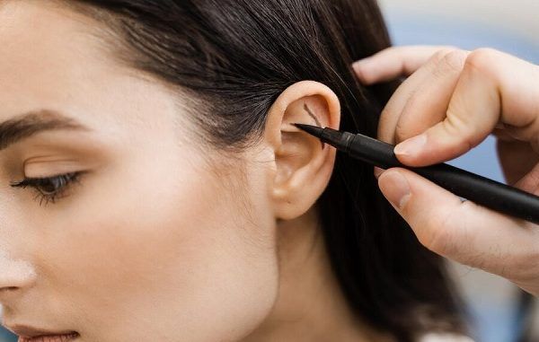 Surgeon draw marking on ear before otoplasty cosmetic surgery
