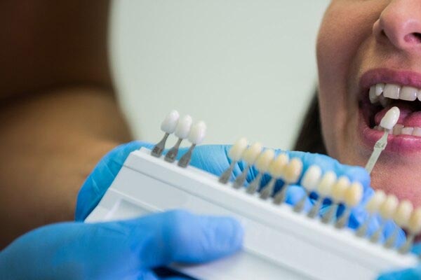 dentist-examines-female-patient-shades-teeth
